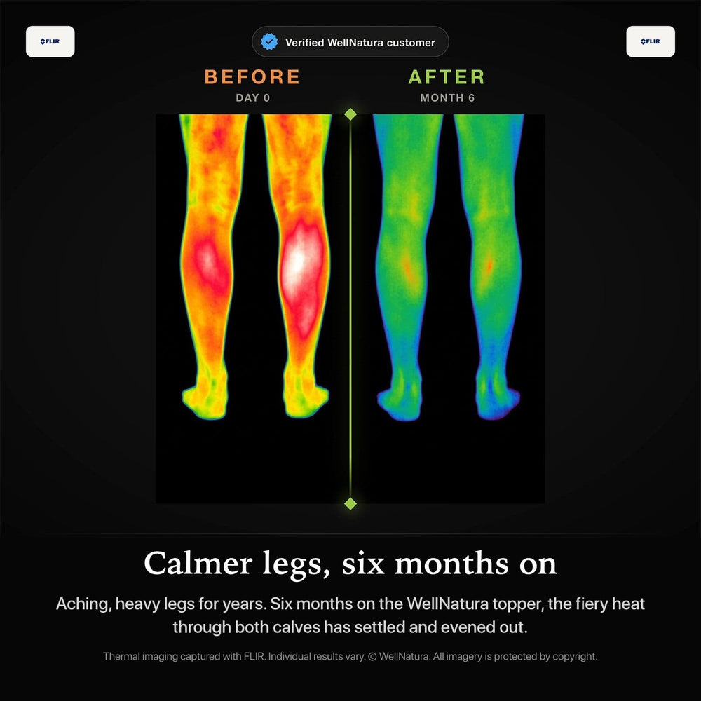 Thermal scan of both calves, before and after grounded sleep