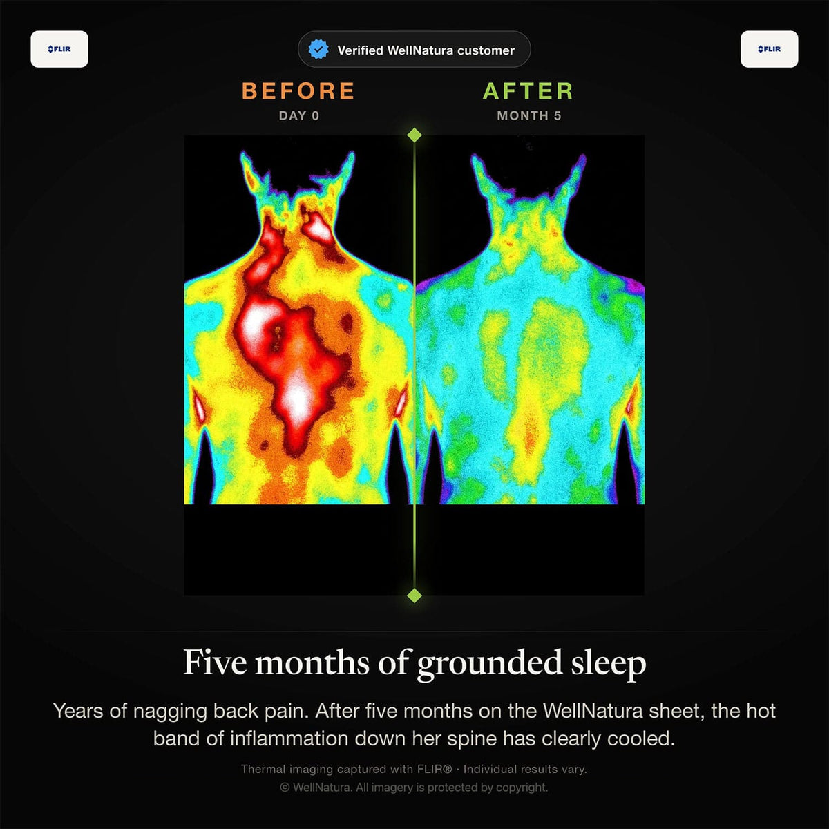 Thermal images before and after five months on the WellNatura grounding sheet: back